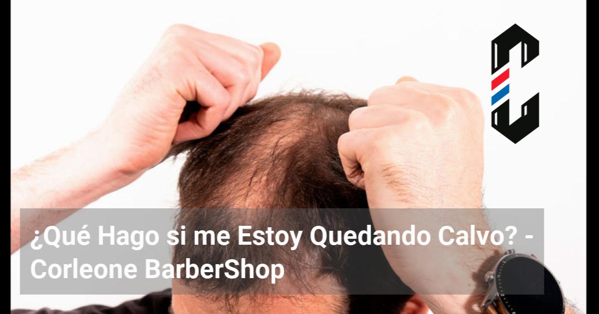 Qué Hago si me Estoy Quedando Calvo Corleone BarberShop